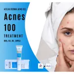 Gel trị mụn Acnes 100 hỗ trợ dưỡng da, giảm mụn, mờ sẹo, ngừa vết thâm, ngừa tái phát mụn, sạch bã nhờn trên da (Tuýp 18g)